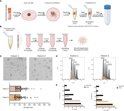 Investigating the tumor-immune microenvironment through extracellular vesicles from frozen patient biopsies and 3D cultures